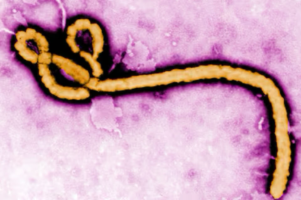 A microscopic image showing a long, filamentous structure with a looped end, set against a purple background.